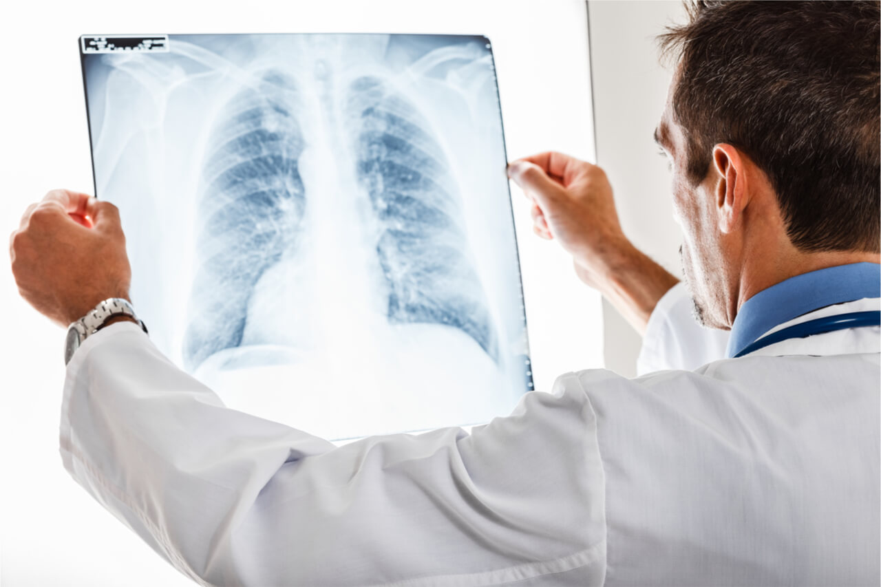 doctor looking at x ray showing chronic lung disease