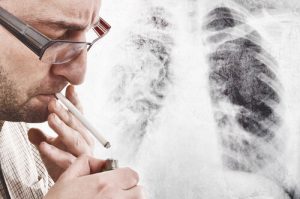 smoker with chronic lung disease